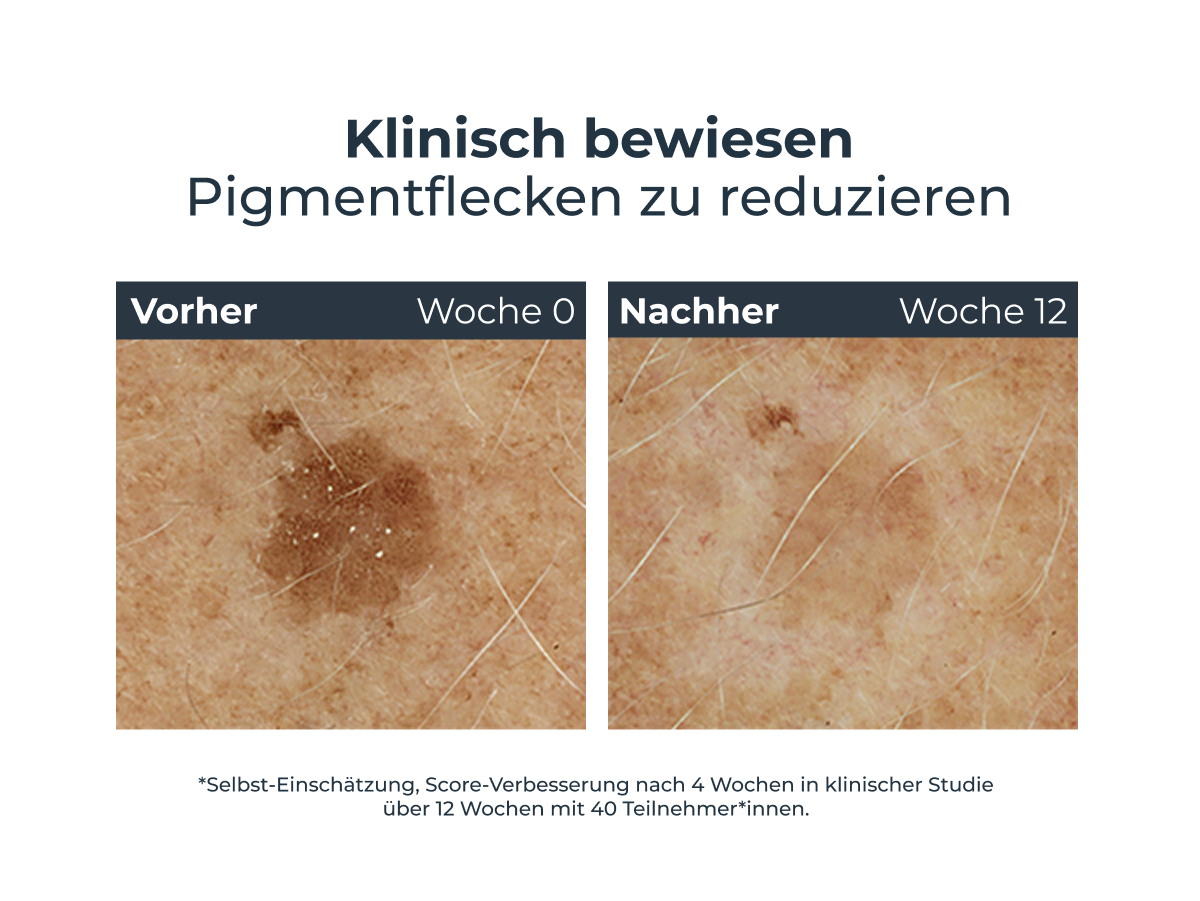Anti-Aging Gesichtscreme Antifaltencreme Feuchtigkeitscreme Haut Faltencreme Anti Aging Creme Gesichtspflege Anti Ageing Hyaluronsäure Anti Age Hyaluron Filler Hautalterung vorbeugen Antifalten gegen Falten straffe Haut Tagespflege Tagescreme Creme gegen Falten Feuchtigkeit LSF 30 Lichtschutzfaktor 30